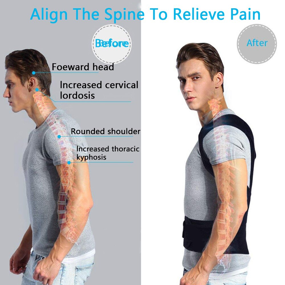 Idavita Pro Posture Corrector — Adjustable Back & Shoulder Support